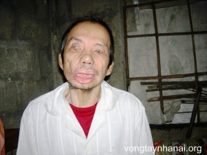 HTV Nguyen Hoi  (Copy)